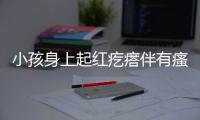 小孩身上起红疙瘩伴有瘙痒应该怎么办